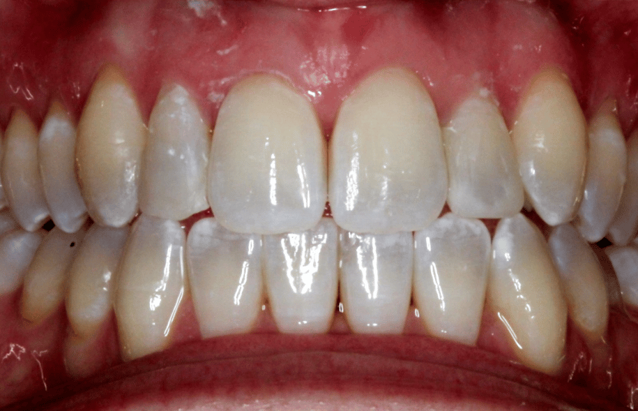 After -Ashbourne Road Dental