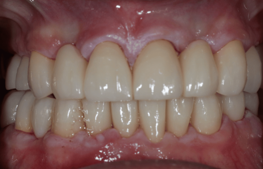 After -Ashbourne Road Dental