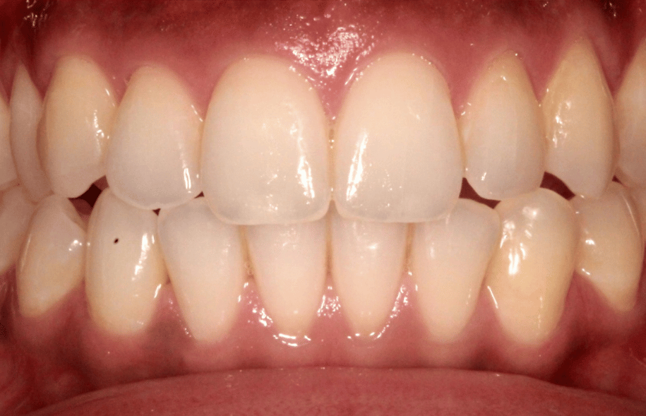 After -Ashbourne Road Dental