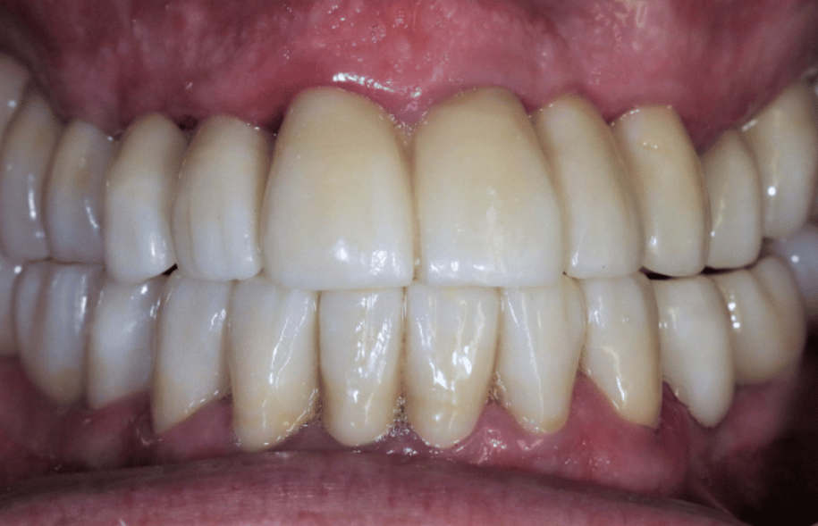 After -Ashbourne Road Dental