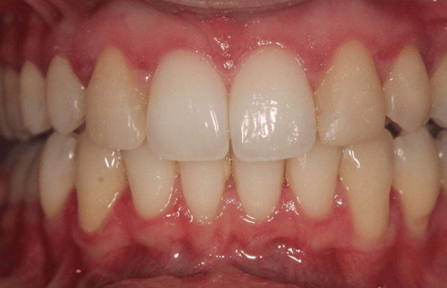 After -Ashbourne Road Dental