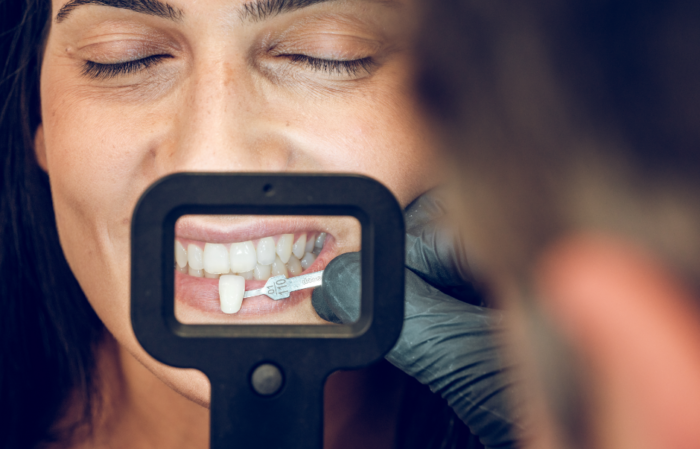 Close up of a mixed race young woman having cosmetic dental treatment. The dentiset is shining a light onto her teeth.